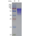 page-flp120102 prokr1 strep sp1