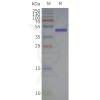 page-flp120103 gpr65 strep sp1