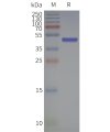 page-flp120103 gpr65 strep sp1