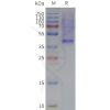 page-flp120122 mc4r strep sp1