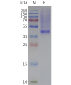 page-flp120122 mc4r strep sp1