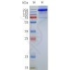 page-flp120128a mbp trpv1 strep sp1