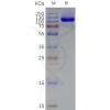 page-flp120135 grm2 strep sp1