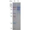 page-flp120161 5ht1a strep sp1