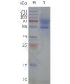 page-flp120161 5ht1a strep sp1