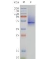 page-flp120162 5ht1b strep sp1