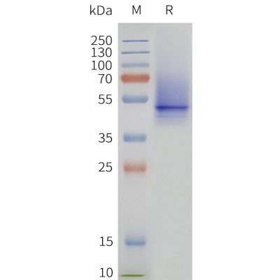 page-flp120162 5ht1b strep sp1
