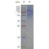 page-flp120168 5ht2c strep sp1