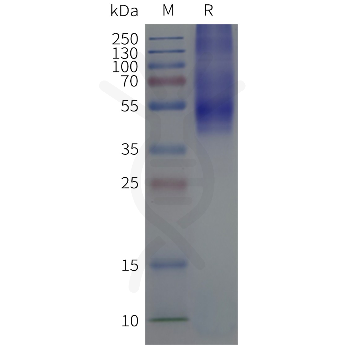 flp120169-5ht4r-strep-sp1.png