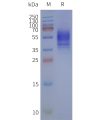 page-flp120173 adora1 strep sp1