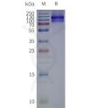page-flp120179 chrm3 strep sp1