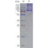 page-flp120185 adra1d strep sp1