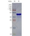 page-flp120187 adra2b strep sp1