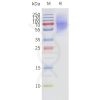 page-flp120190 adrb3 strep sp1