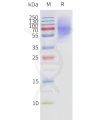 page-flp120190 adrb3 strep sp1