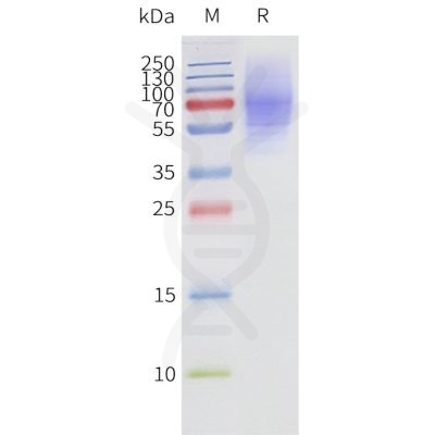 page-flp120190 adrb3 strep sp1