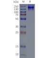 page-flp120193 adgrb1 strep sp1