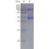 page-flp120202 adgrg3 strep sp1