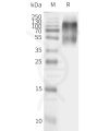 page-flp120212 agtr2 strep sp1