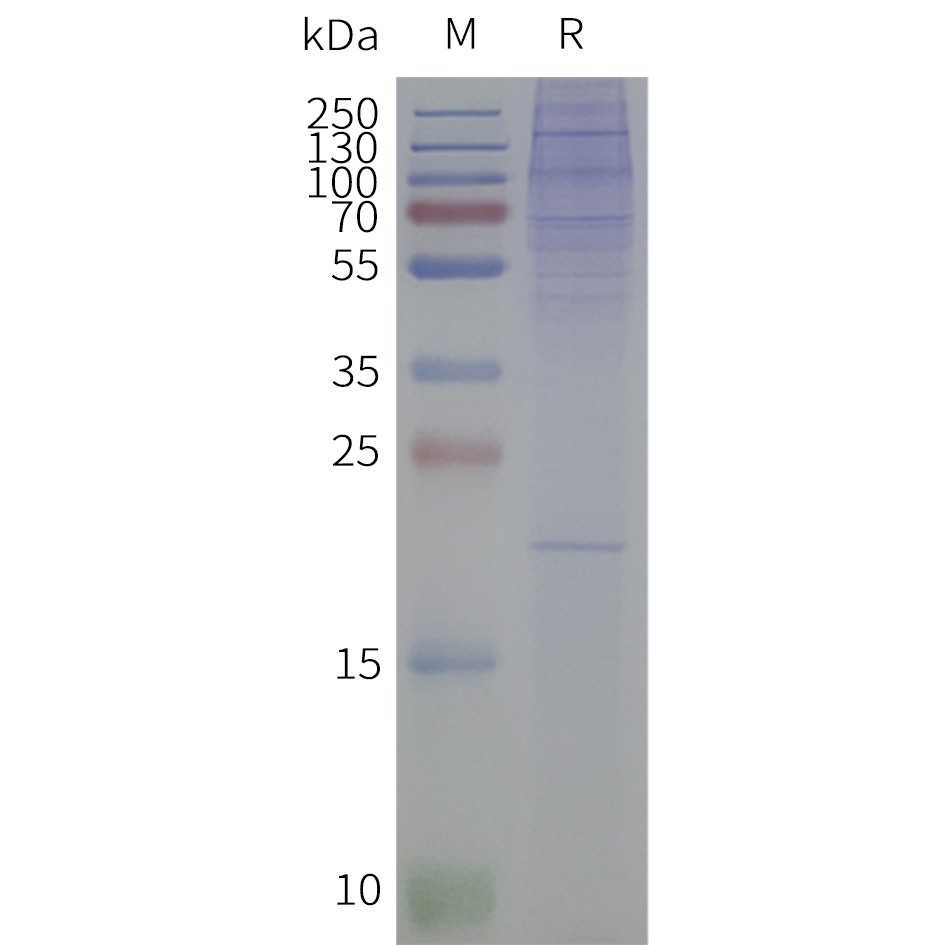 flp120215-c3ar1-strep-sp1.jpg