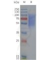 page-flp120229 drd1 strep sp1