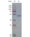 page-flp120232 drd4 strep sp1
