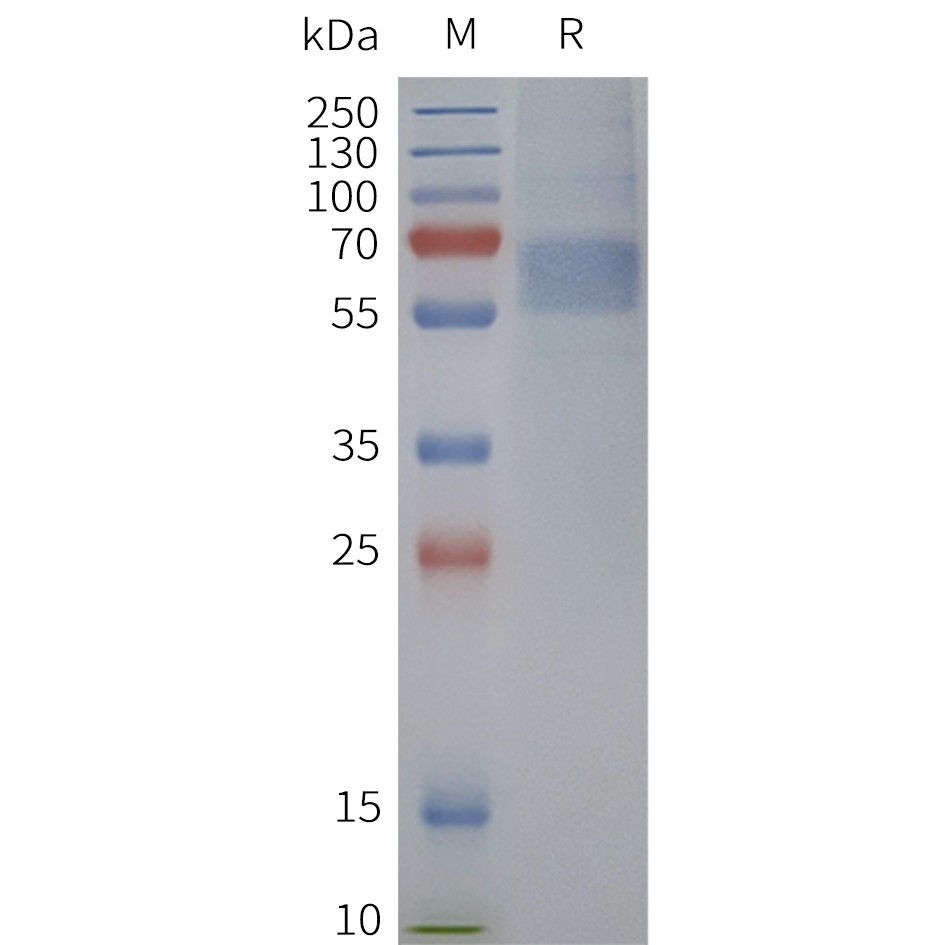flp120233-drd5-strep-sp1.jpg