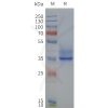 page-flp120236 ffar2 strep sp1