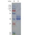 page-flp120236 ffar2 strep sp1