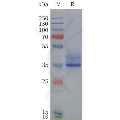 page-flp120236 ffar2 strep sp1