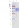 page-flp120237 ffar3 strep sp1