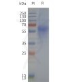 page-flp120239 fpr1 strep sp1