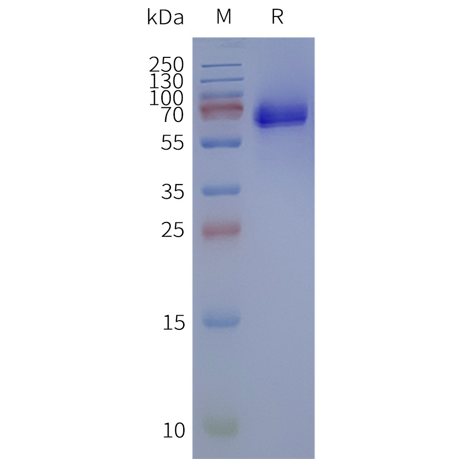 flp120242-fzd1-strep-sp1.jpg