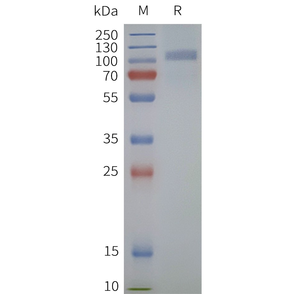 flp120246-fzd6-strep-sp1.jpg