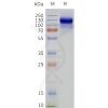 page-flp120252 gabr2 strep sp1
