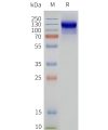 page-flp120252 gabr2 strep sp1