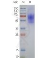 page-flp120253 galr1 strep sp1