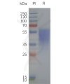 page-flp120258 ghsr strep sp1