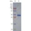 page-flp120261 gpr119 strep sp1
