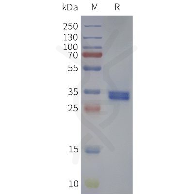 page-flp120261 gpr119 strep sp1