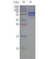 page-flp120266 gpr143 strep sp1
