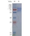 page-flp120278 gpr161 strep sp1