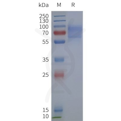 page-flp120278 gpr161 strep sp1