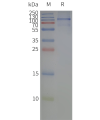 page-flp120290 gprc6a strep sp1