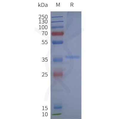 page-flp120291 gper1 strep sp1