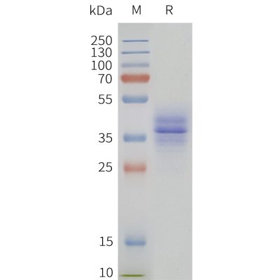 page-flp120293 gpr15 strep sp1