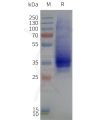 page-flp120306 gpr35 strep sp1