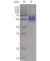 page-flp120307 gpr37 strep sp1