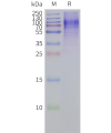 page-flp120311 gpr45 strep sp1