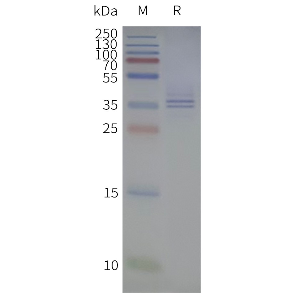 flp120321-gpr88-strep-sp1.jpg